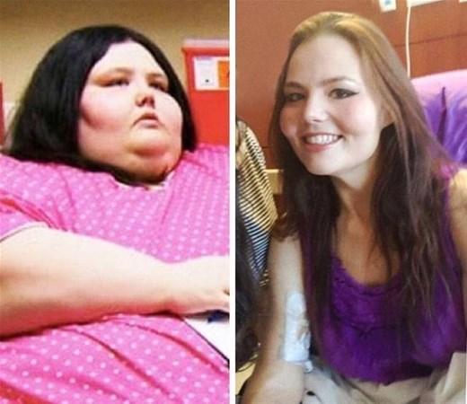 Arıqladıqdan sonra tanınmaz hala düşdülər -  FOTOLAR